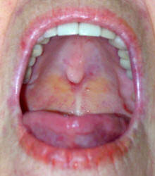 mouth torus