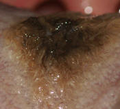 Close-Up View Hairy Tongue